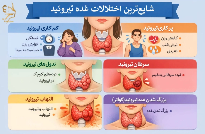شایعترین اختلالات غده تیروئید