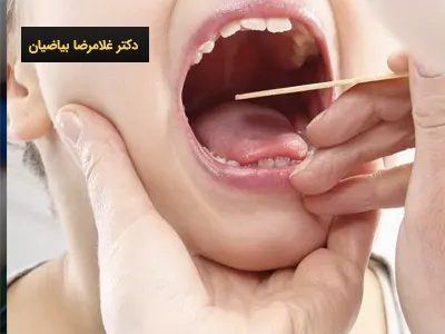 بهترین متخصص جراحی لوزه