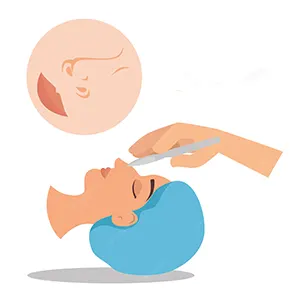 پیش از جراحی بینی