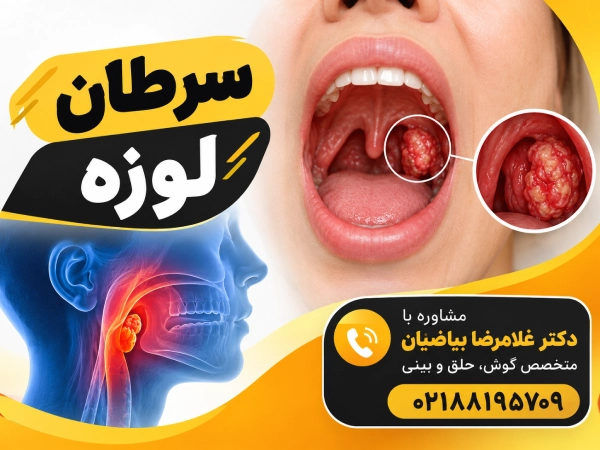 سرطان لوزه