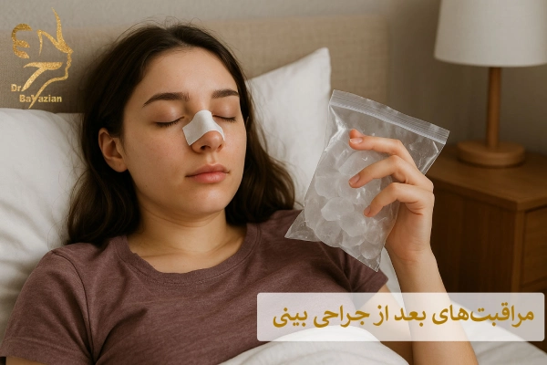 مراقبتهای بعد از جراحی بینی