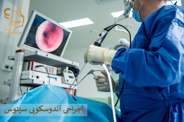 جراحی آندوسکوپی سینوس
