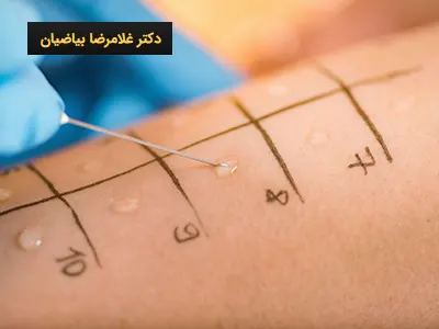تست آلرژی