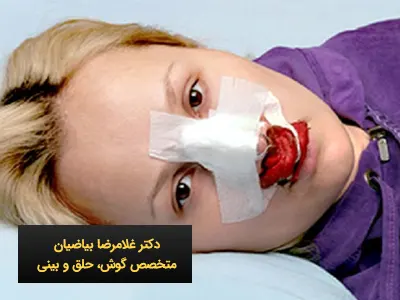 بهترین جراح بینی
