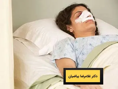 مراقبت های بعد از جراحی بینی