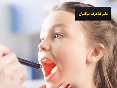 جراحی لوزه سوم