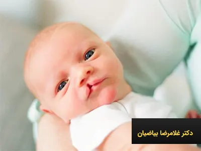 روش های پیشگیری از شکاف کام و لب
