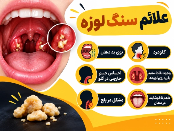 علائم سنگ لوزه