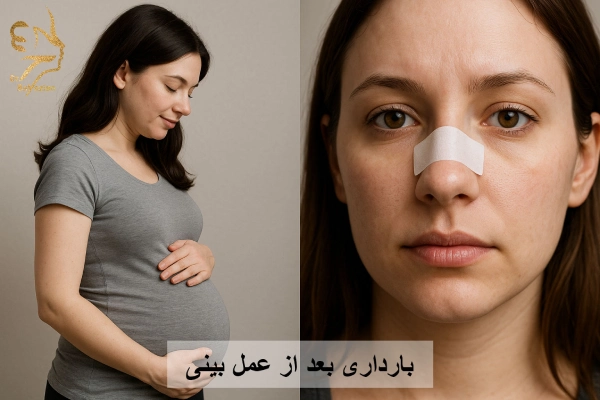 بارداری بعد از عمل بینی
