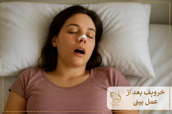 خروپف بعد از عمل بینی