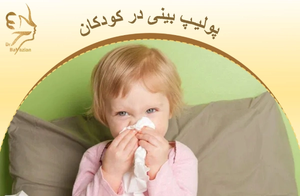 پولیپ بینی در کودکان چیست