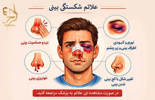 علائم و نشانههای شکستگی بینی