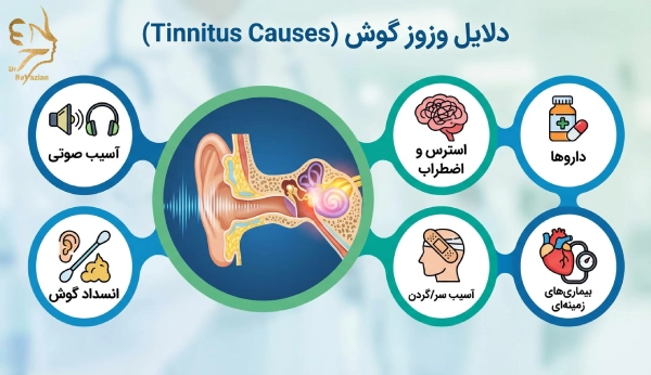 علت وزوز گوش
