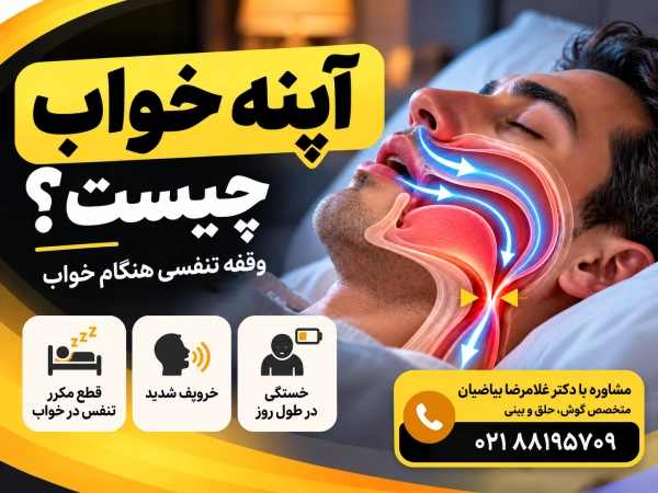 آپنه خواب