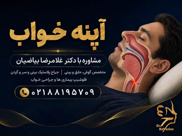 آپنه خواب