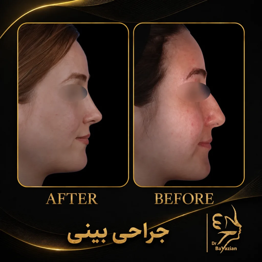 نمونه جراحی بینی