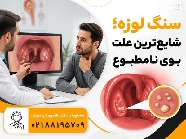 سنگهای کوچک سفید در حفرههای لوزه